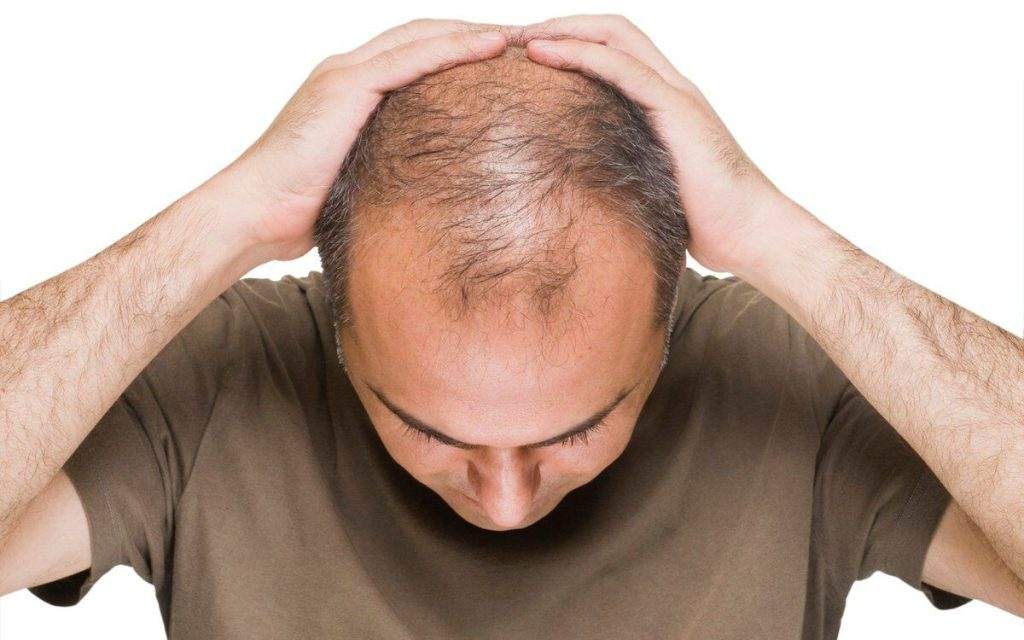 پیشگیری از ریزش مو