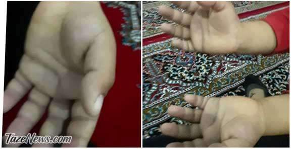 کتک و شکنجه بچه کلاس اول